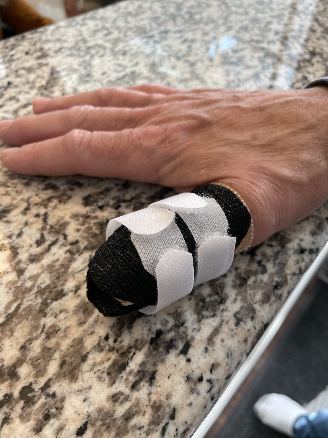 What is the Difference Between a Splint and a Brace? - North 49 Physical  Therapy, Balance & Dizziness Centre in Saskatoon